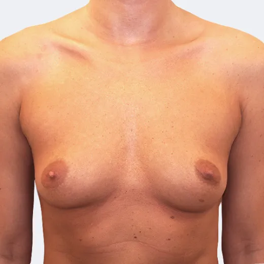 Image before