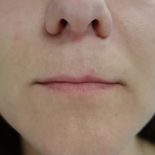 Image before