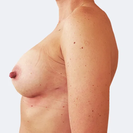 Image after