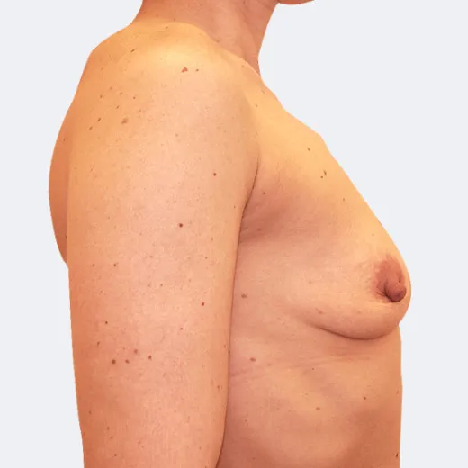 Image before