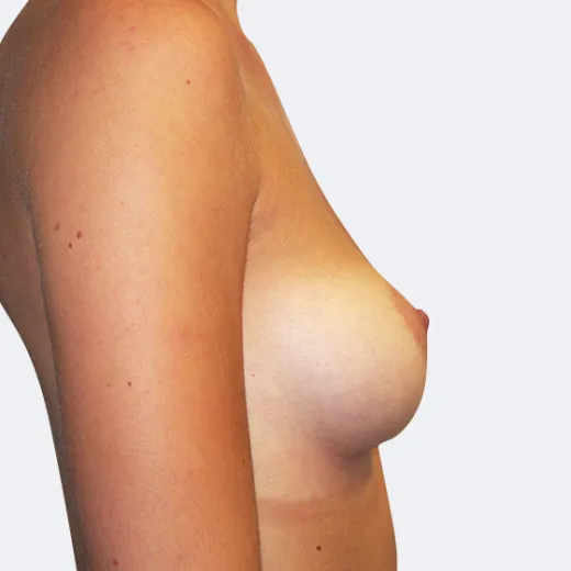 Image before