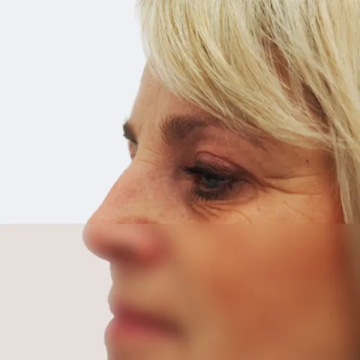 Image after