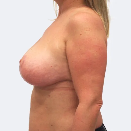 Image after