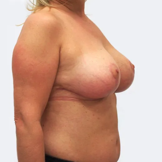 Image after