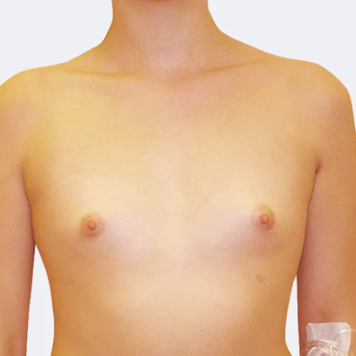 Image before