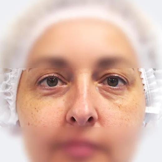 Image before