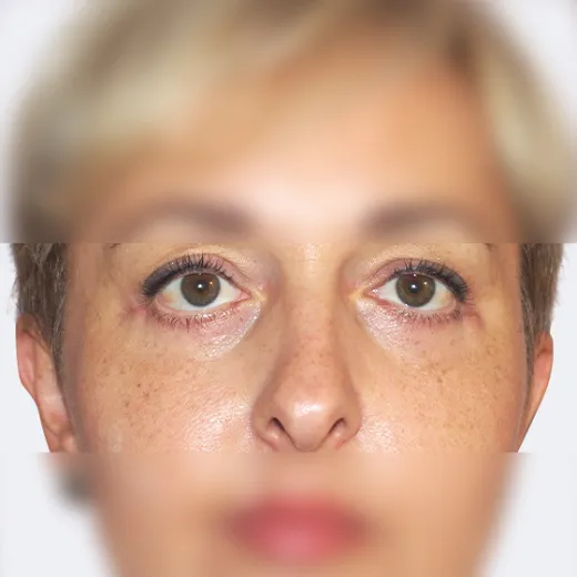 Image after