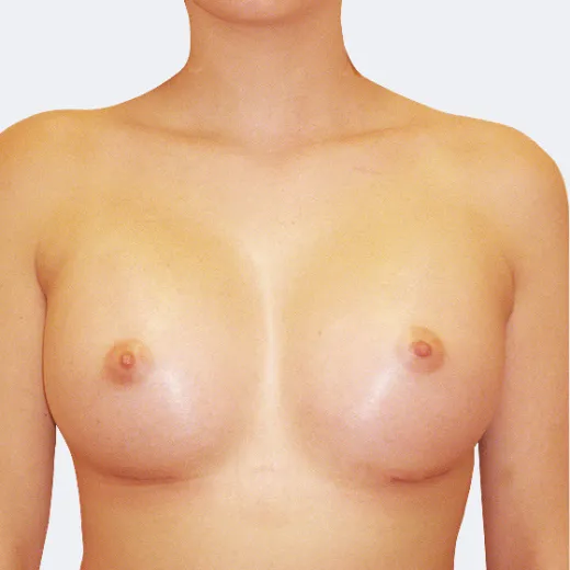Image after