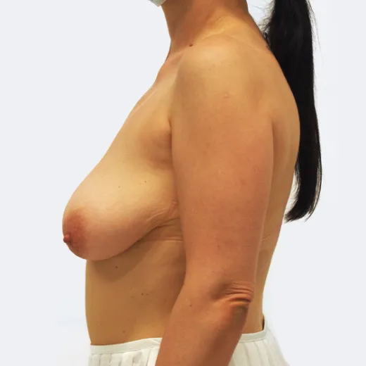 Image before