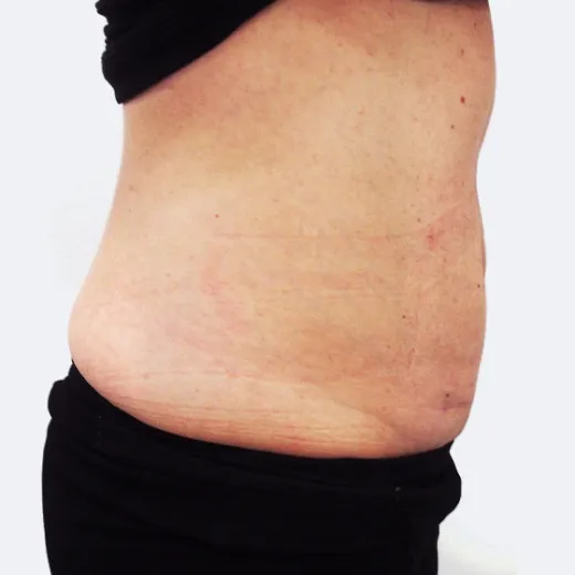 Image after