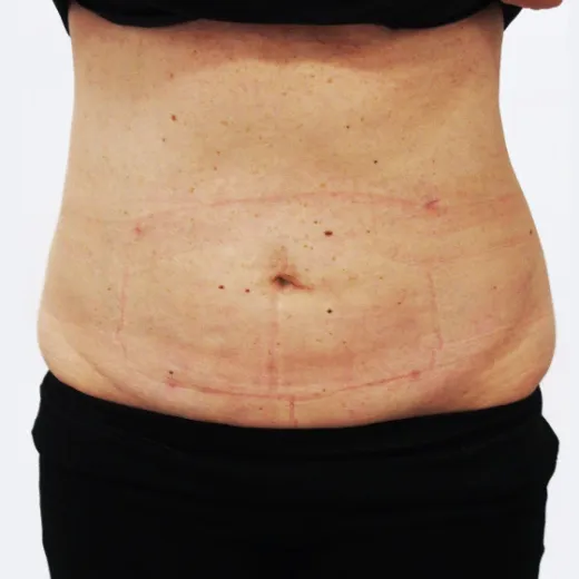 Image after