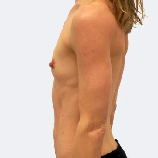 Image before