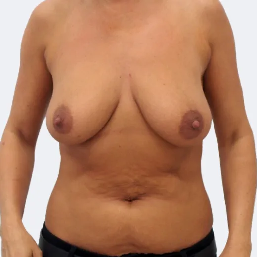 Image before