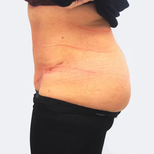 Image after