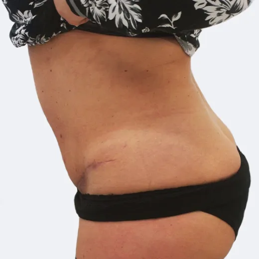 Image after