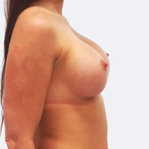 Image after