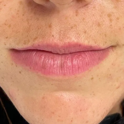 Image before
