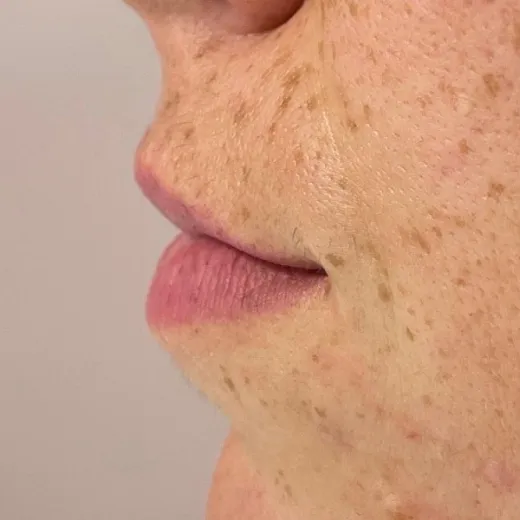 Image before