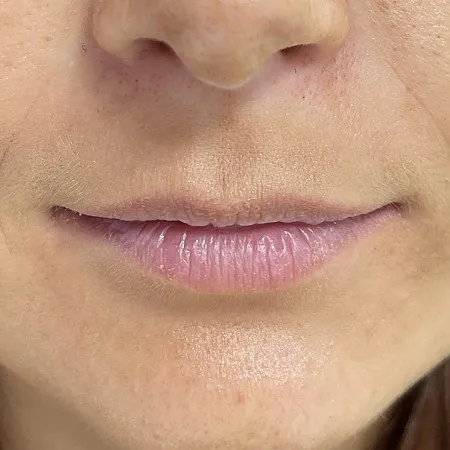 Image before