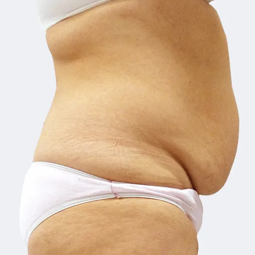 Image before