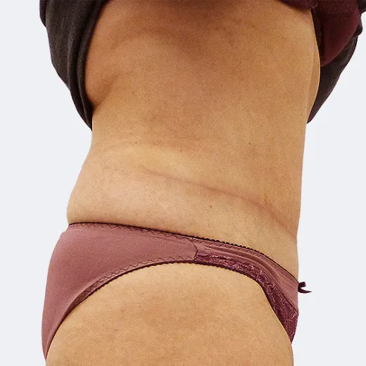 Image after