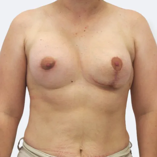 Image after