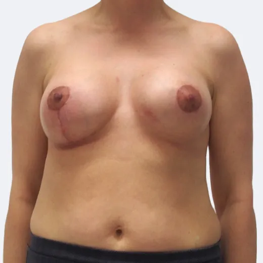 Image after