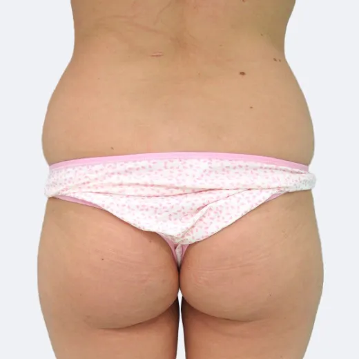 Image before