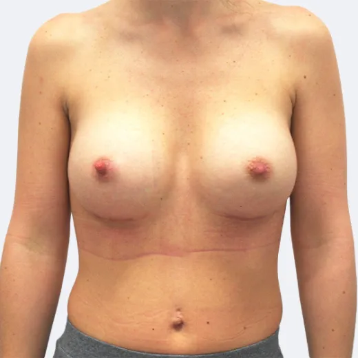 Image after
