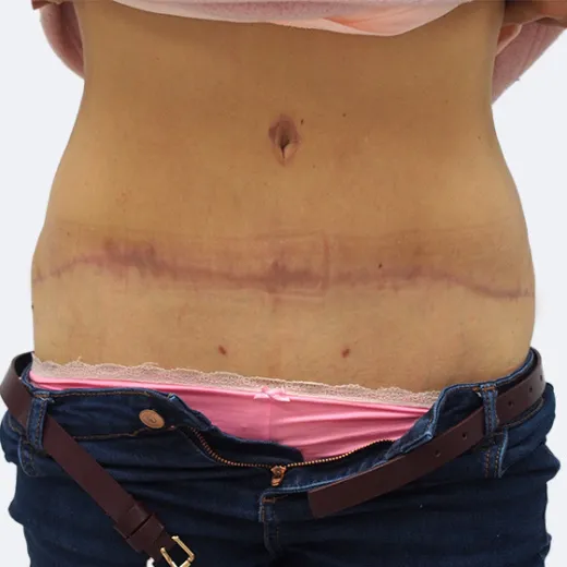 Image after