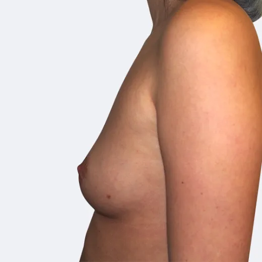 Image before