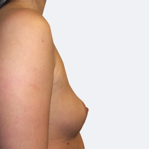 Image before
