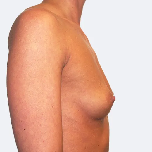 Image before