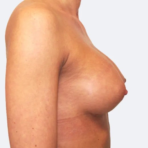 Image after