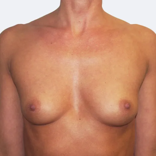 Image before