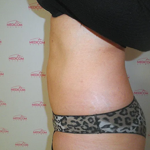 Image after