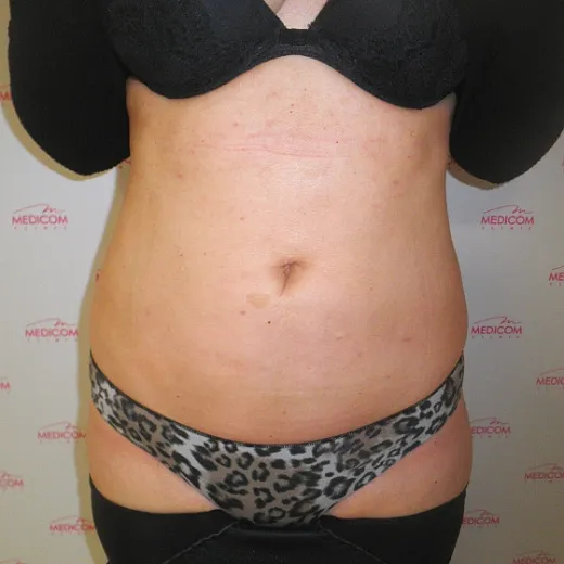 Image after