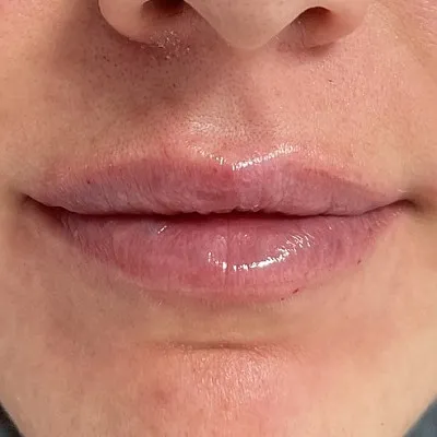 Image after