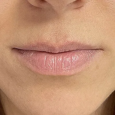 Image before