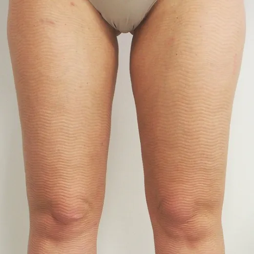 Image after