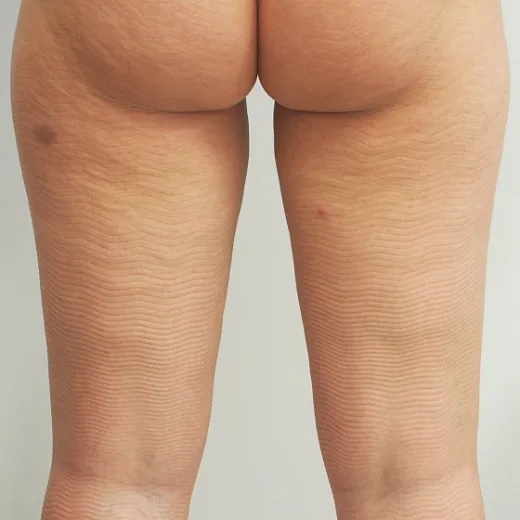 Image after