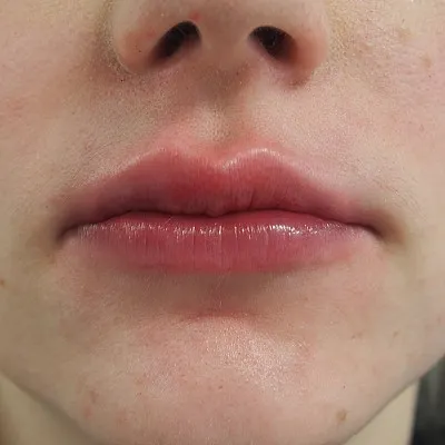 Image after