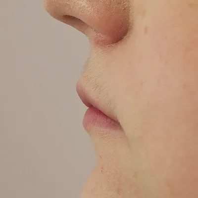 Image before