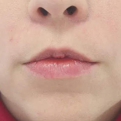 Image before