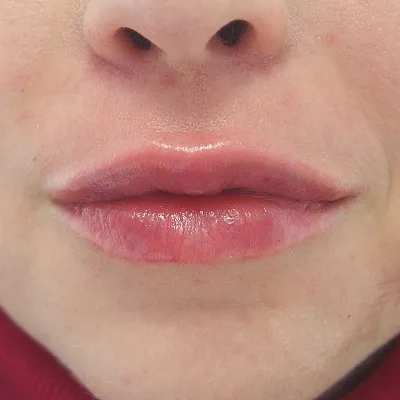 Image after