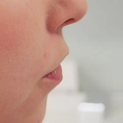 Image before