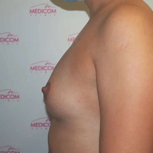 Image before