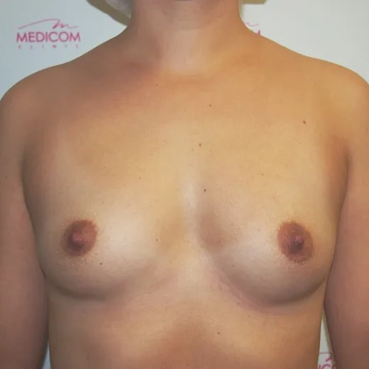 Image before