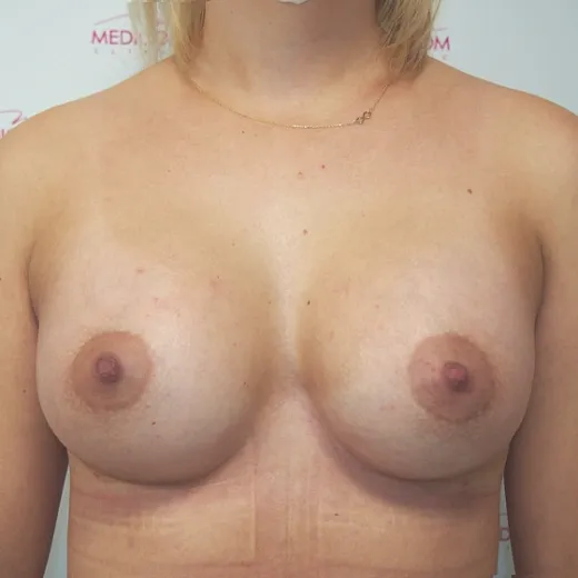 Image after