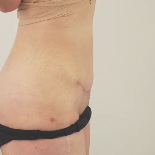 Image after